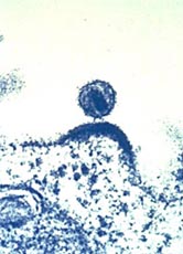 Ein HI-Virus löst sich aus einer Immunzelle heraus.
