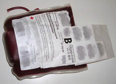 Spenderblut kann Leben retten: Bei einem großen Blutverlust muss eine sofortige "Transfusion" vorgenommen werden.