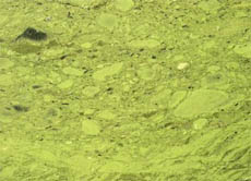 So sieht es aus, wenn dicke Algenschichten die Wasseroberfläche bedecken. Diese Gewässer sind für Tiere unbewohnbar.
