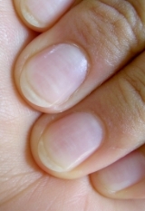 Als Spickzettel taugt der Fingernagel-Speicher leider nicht. Um die Informationen lesen zu können, braucht man ein Mikroskop und ein ganz spezielles Licht.
